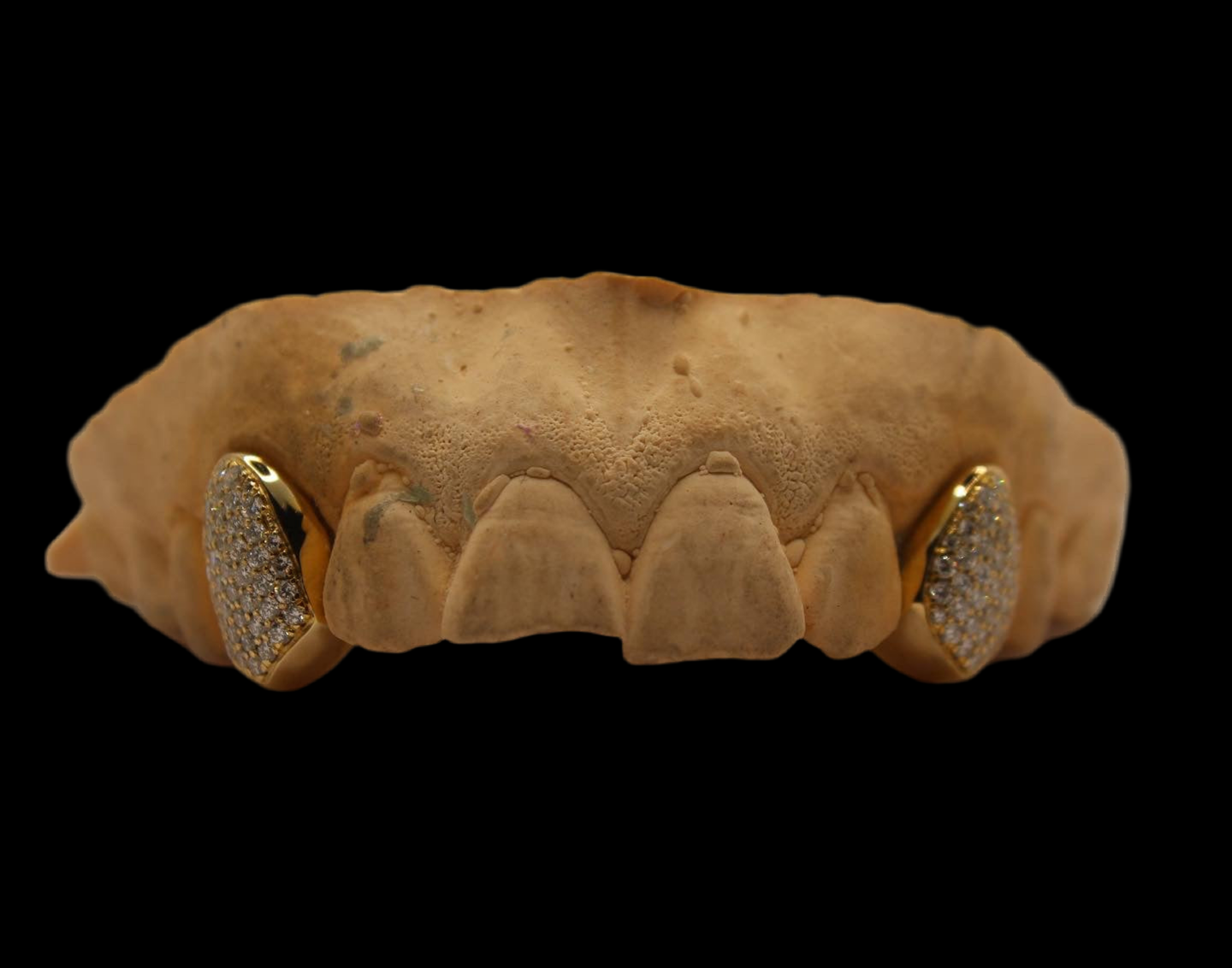 2 Diamond VS+ Grillz