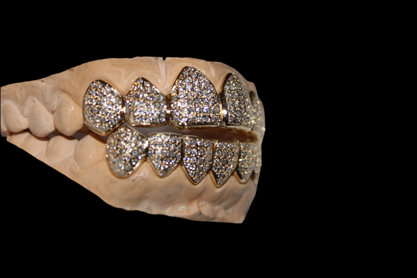 Diamond Grillz