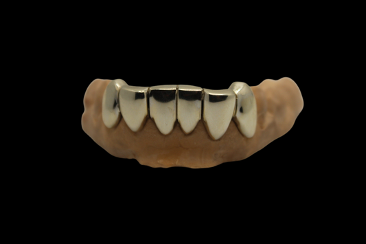 6 Set Gold Grillz