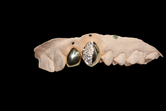 2 Gold Grillz Half VS+